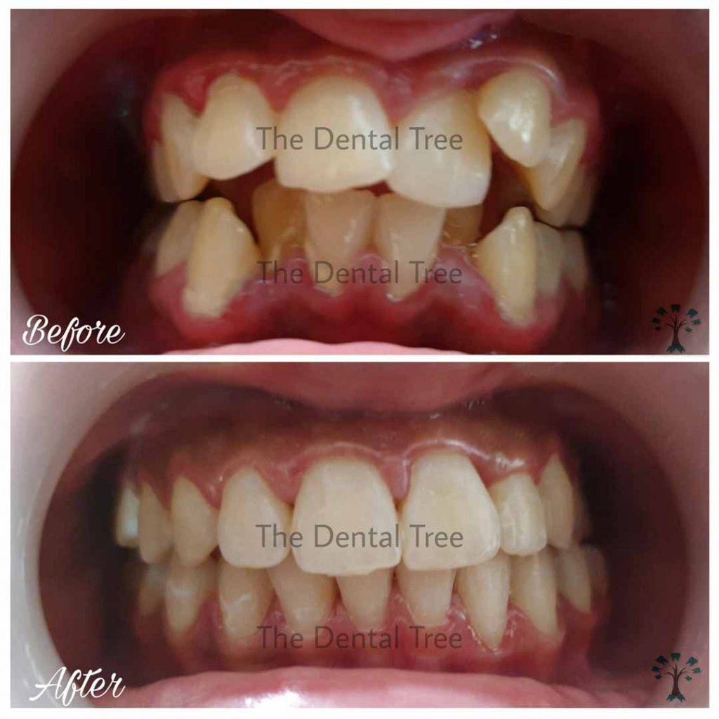 Best Dental Clinic In Indirapuram