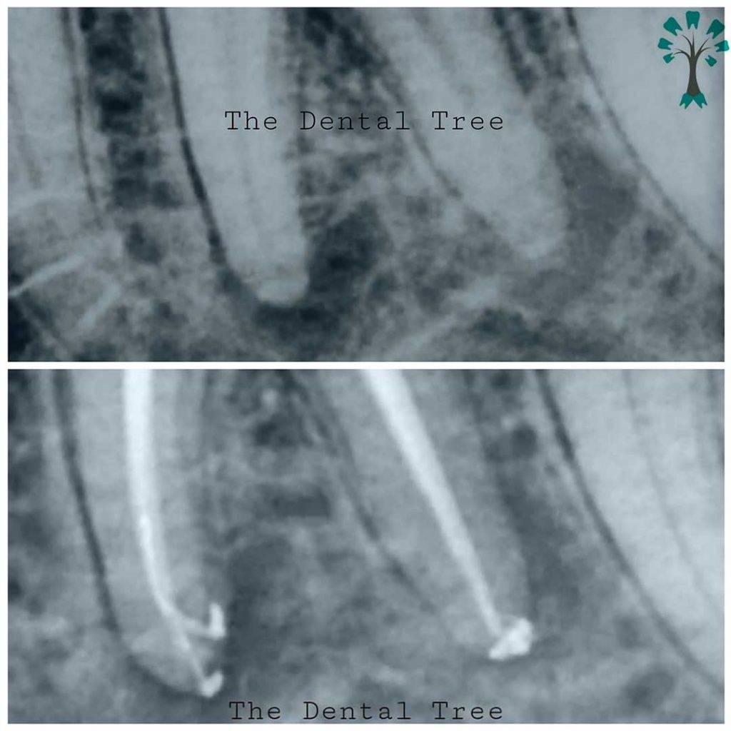 Best Dental Clinic In Indirapuram