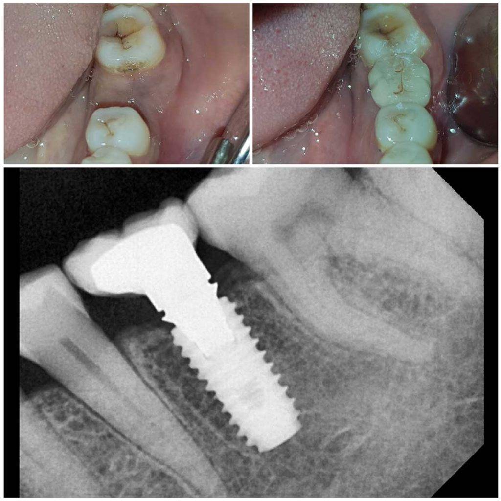 Best Dental Clinic In Indirapuram