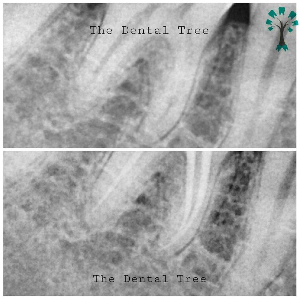 Best Dental Clinic In Indirapuram