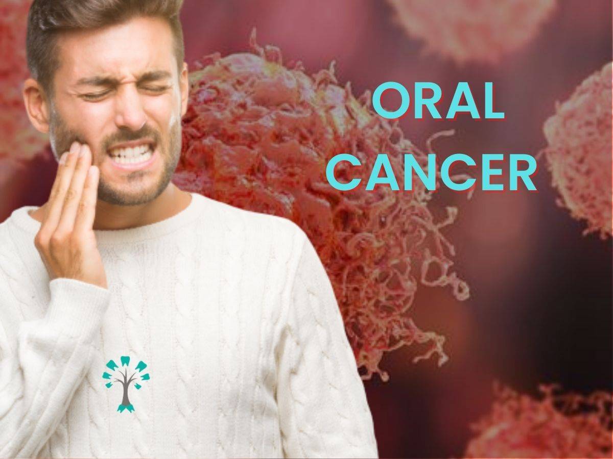 Everything You Need To Know About Oral Cancer