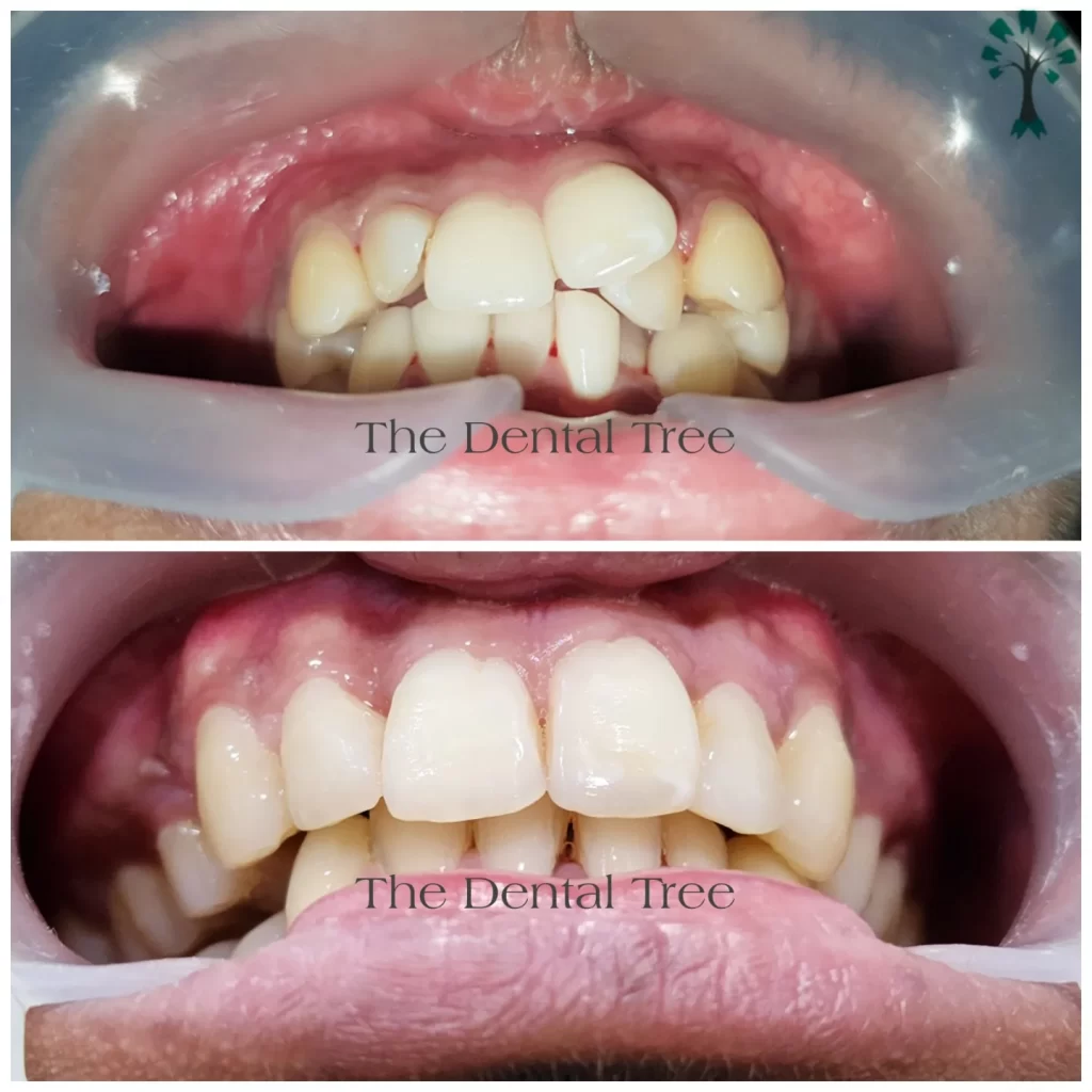 treatment-before-after (2)