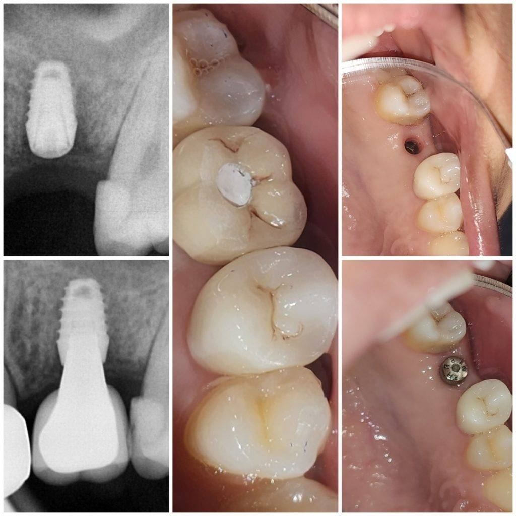 treatment-before-after (6)