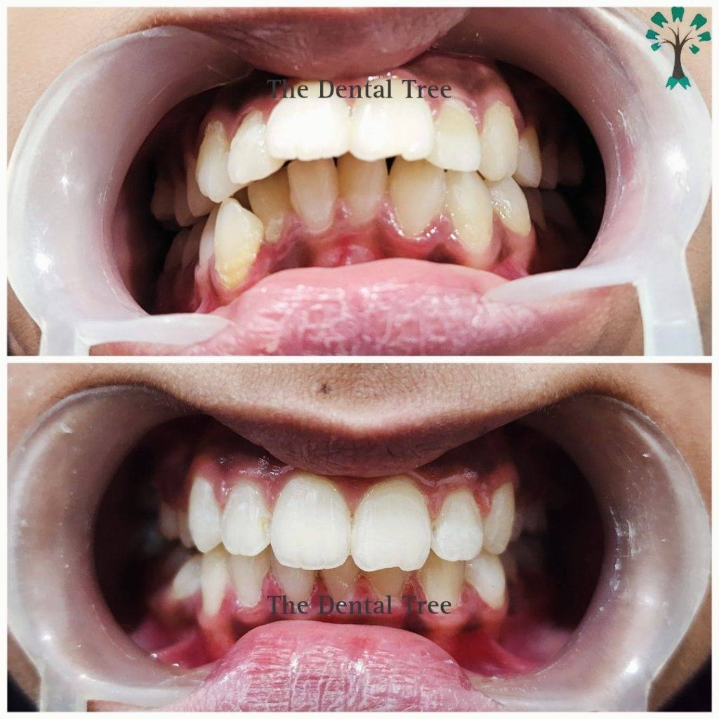 treatment-before-after (7)